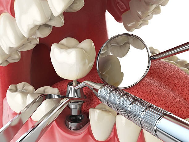 Best Cracked Tooth Emergency Dentist  in Mountainhome, PA